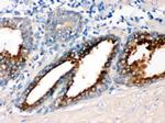 GNAQ Antibody in Immunohistochemistry (Paraffin) (IHC (P))