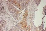 GRB7 Antibody in Immunohistochemistry (Paraffin) (IHC (P))