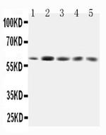 GRB7 Antibody in Western Blot (WB)