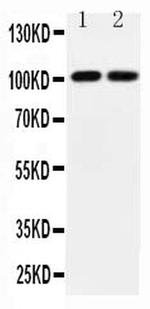 GluR3 Antibody in Western Blot (WB)