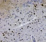 GRIK1 Antibody in Immunohistochemistry (Paraffin) (IHC (P))