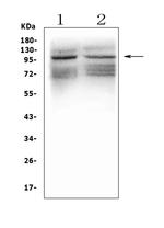 GRIK1 Antibody in Western Blot (WB)