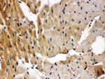 GRK5 Antibody in Immunohistochemistry (Paraffin) (IHC (P))