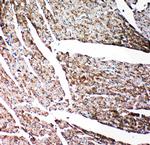 Gelsolin Antibody in Immunohistochemistry (Paraffin) (IHC (P))