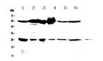 GSTM3 Antibody in Western Blot (WB)