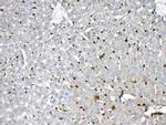 GSTP1 Antibody in Immunohistochemistry (Paraffin) (IHC (P))