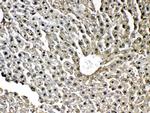 GSTP1 Antibody in Immunohistochemistry (Paraffin) (IHC (P))