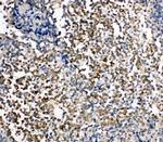 KIM-1 Antibody in Immunohistochemistry (Paraffin) (IHC (P))