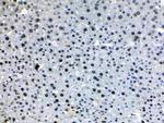 HDGF Antibody in Immunohistochemistry (Paraffin) (IHC (P))