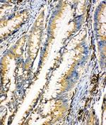 HEXA Antibody in Immunohistochemistry (Paraffin) (IHC (P))