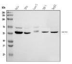 HEXA Antibody in Western Blot (WB)