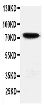 HIF3A Antibody in Western Blot (WB)