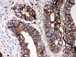 HLA-A Antibody in Immunohistochemistry (Paraffin) (IHC (P))