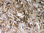 HLA-C Antibody in Immunohistochemistry (Paraffin) (IHC (P))