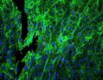 HLA-C Antibody in Immunohistochemistry (Paraffin) (IHC (P))