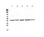 HMBS Antibody in Western Blot (WB)