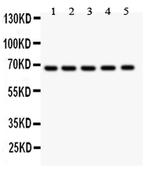 HNF1A Antibody in Western Blot (WB)