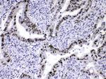 hnRNP A1 Antibody in Immunohistochemistry (Paraffin) (IHC (P))