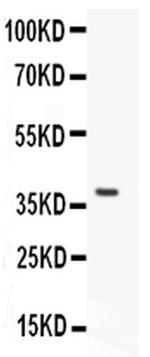 HOXA11 Antibody in Western Blot (WB)