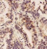 HSD11B1 Antibody in Immunohistochemistry (Paraffin) (IHC (P))