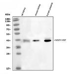 HSD11B2 Antibody in Western Blot (WB)