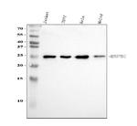 ERAB Antibody in Western Blot (WB)