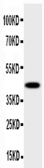 HSD17B2 Antibody in Western Blot (WB)