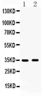 HSD17B6 Antibody in Western Blot (WB)