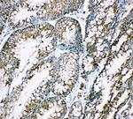 HSPE1 Antibody in Immunohistochemistry (Paraffin) (IHC (P))