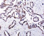 HSPE1 Antibody in Immunohistochemistry (Paraffin) (IHC (P))