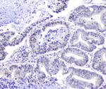 HSP105 Antibody in Immunohistochemistry (Paraffin) (IHC (P))