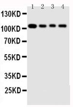 HSP105 Antibody in Western Blot (WB)