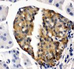 Bone SialoProtein Antibody in Immunohistochemistry (Paraffin) (IHC (P))