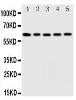 Iduronate 2 Sulfatase Antibody in Western Blot (WB)