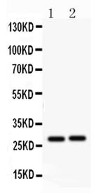 IGFBP-1 Antibody in Western Blot (WB)