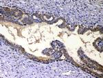 IGFBP2 Antibody in Immunohistochemistry (Paraffin) (IHC (P))