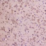 IGFBP2 Antibody in Immunohistochemistry (Paraffin) (IHC (P))