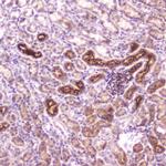 IGFBP2 Antibody in Immunohistochemistry (Paraffin) (IHC (P))