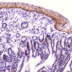 IGFBP2 Antibody in Immunohistochemistry (Paraffin) (IHC (P))