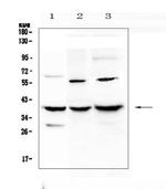 IGFBP2 Antibody in Western Blot (WB)