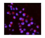 IL15RA Antibody in Immunocytochemistry (ICC/IF)