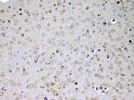 IL15RA Antibody in Immunohistochemistry (Paraffin) (IHC (P))