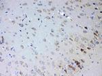 IL15RA Antibody in Immunohistochemistry (Paraffin) (IHC (P))