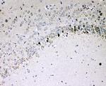 IL-16 Antibody in Immunohistochemistry (Paraffin) (IHC (P))