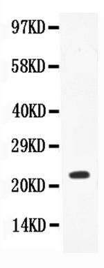 IL-18 Antibody in Western Blot (WB)