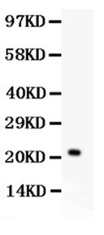 IL-18 Antibody in Western Blot (WB)