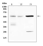 IL23R Antibody in Western Blot (WB)