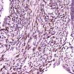 IL1F6 Antibody in Immunohistochemistry (Paraffin) (IHC (P))