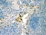 IRF7 Antibody in Immunohistochemistry (Paraffin) (IHC (P))