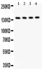 IRS2 Antibody in Western Blot (WB)